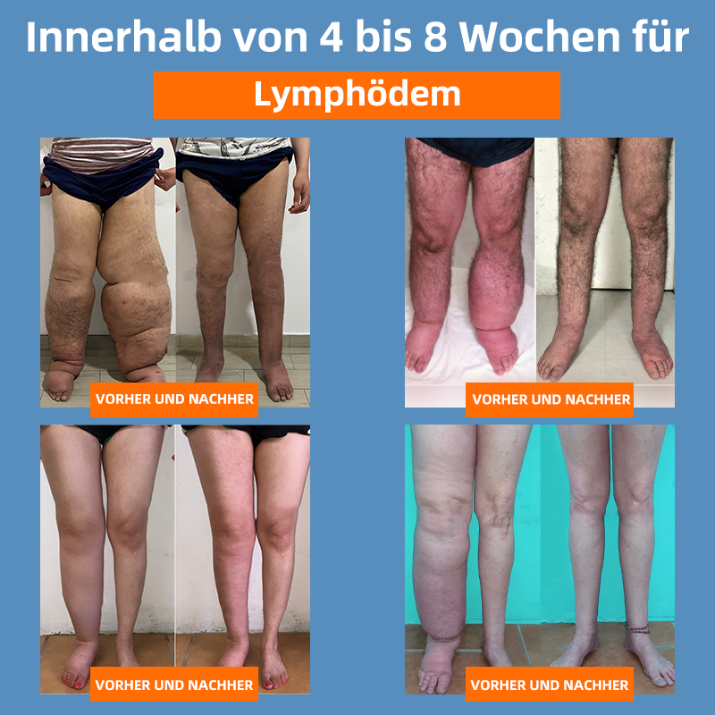 đ„ RFMediThermâą Radiofrequente KrĂ€uter-Thermo-Kniebandage(Von RKI-Experten empfohlen - Geeignet fĂŒr alle Beinleiden)đ