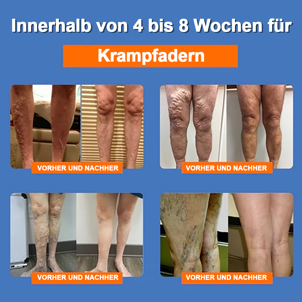 đ„ RFMediThermâą Radiofrequente KrĂ€uter-Thermo-Kniebandage(Von RKI-Experten empfohlen - Geeignet fĂŒr alle Beinleiden)đ