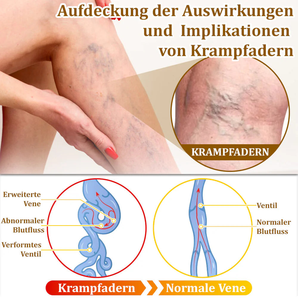 Bostore™ Bienengift-Therapie-Creme, zur Behandlung von Ekzemen, Akne, Altersflecken, Krampfadern, Hautrissen, Pilzinfektionen und Warzen sowie anderen Hautproblemen.👨⚕️