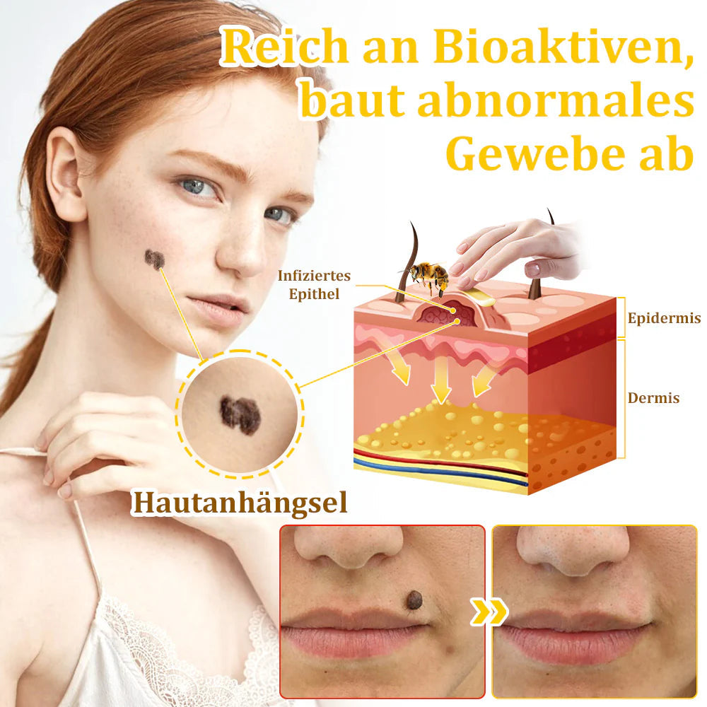 Bostore™ Bienengift-Therapie-Creme, zur Behandlung von Ekzemen, Akne, Altersflecken, Krampfadern, Hautrissen, Pilzinfektionen und Warzen sowie anderen Hautproblemen.👨⚕️