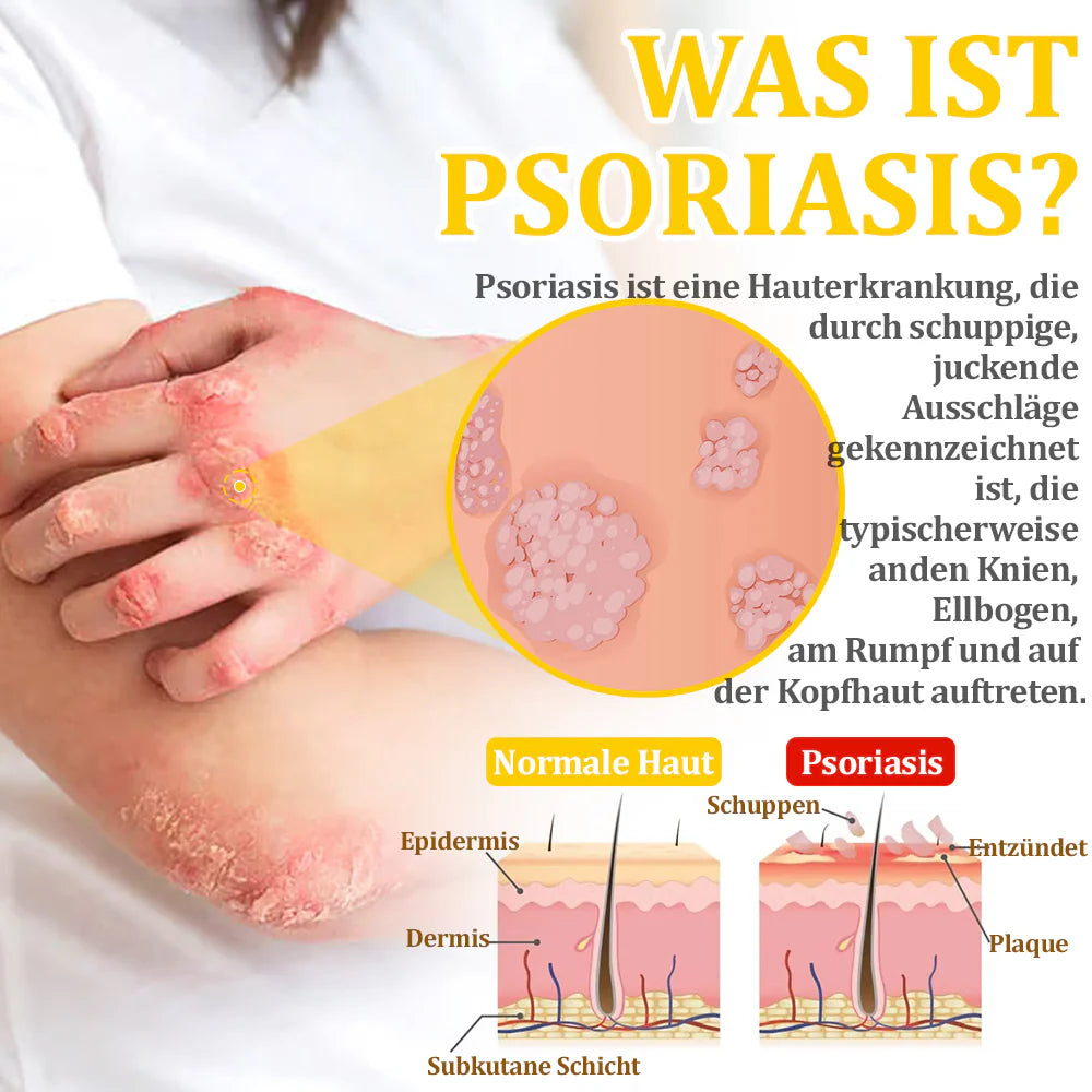 Bostore™ Bienengift-Therapie-Creme, zur Behandlung von Ekzemen, Akne, Altersflecken, Krampfadern, Hautrissen, Pilzinfektionen und Warzen sowie anderen Hautproblemen.👨⚕️