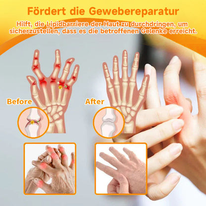 Offizieller Shop: FATONG™ Magnesiumöl & Bienengift-Gelenk-Heilspray👨‍⚕️Vom Deutsche Gesellschaft für Orthopädie und Unfallchirurgie (DGOU) genehmigt✅Verringerung von Gelenkschwellungen, Schmerzen, Steifheit, Rötung, Wärme, Schmerzen und Gelenkermüdung