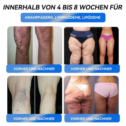 IFMAGIC® GLP-1 Pro Schlankheits-Trinklösung 👩‍⚕️Empfehlung eines Adipositas-Spezialisten 💧keine Nebenwirkungen, geeignet für alle Altersgruppen👍