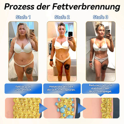 IFMAGIC® GLP-1 Pro Schlankheits-Trinklösung 👩‍⚕️Empfehlung eines Adipositas-Spezialisten 💧keine Nebenwirkungen, geeignet für alle Altersgruppen👍