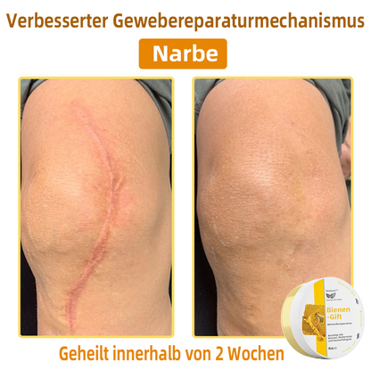 👍 𝐛𝐨𝐬𝐭𝐨𝐫𝐞™ 𝐁𝐢𝐞𝐧𝐞𝐧𝐠𝐢𝐟𝐭-𝐓𝐡𝐞𝐫𝐚𝐩𝐢𝐞-𝐂𝐫𝐞𝐦𝐞 🇩🇪 𝐆𝐨𝐞𝐝𝐤𝐞𝐮𝐫𝐢𝐧𝐠 𝐝𝐨𝐨𝐫 𝐝𝐞𝐫𝐦𝐚𝐭𝐨𝐥𝐨𝐠𝐞𝐧🚀🚀🚀