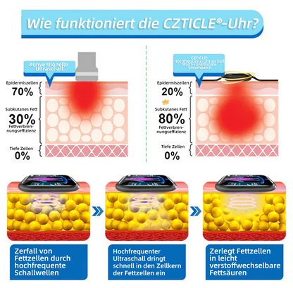 𝐂𝐙𝐓𝐥𝐂𝐋𝐄®𝐇𝐨𝐜𝐡𝐟𝐫𝐞𝐪𝐮𝐞𝐧𝐳-𝐔𝐥𝐭𝐫𝐚𝐬𝐜𝐡𝐚𝐥𝐥-𝐌𝐮𝐥𝐭𝐢𝐟𝐮𝐧𝐤𝐭𝐢𝐨𝐧𝐬-𝐒𝐦𝐚𝐫𝐭𝐰𝐚𝐭𝐜𝐡 💃💃(👩‍⚕️𝑺𝒑𝒆𝒛𝒊𝒆𝒍𝒍 𝒆𝒏𝒕𝒘𝒊𝒄𝒌𝒆𝒍𝒕 𝒛𝒖𝒓 𝑭𝒆𝒕𝒕𝒗𝒆𝒓𝒃𝒓𝒆𝒏𝒏𝒖𝒏𝒈, 𝑩𝒍𝒖𝒕𝒛𝒖𝒄𝒌𝒆𝒓𝒓𝒆𝒈𝒖𝒍𝒊𝒆𝒓𝒖𝒏𝒈, 𝒍𝒚𝒎𝒑𝒉𝒂𝒕𝒊𝒔𝒄𝒉𝒆𝒏 𝑬𝒏𝒕𝒈𝒊𝒇𝒕𝒖𝒏𝒈, 𝑹𝒆𝒅𝒖𝒛𝒊𝒆𝒓𝒖𝒏𝒈 𝒗𝒐𝒏 Ö𝒅𝒆𝒎𝒆𝒏 𝒖𝒏𝒅 𝑵𝒆𝒓𝒗𝒆𝒏𝒆𝒏𝒕𝒔𝒑𝒂𝒏𝒏𝒖𝒏𝒈)🔥🔥