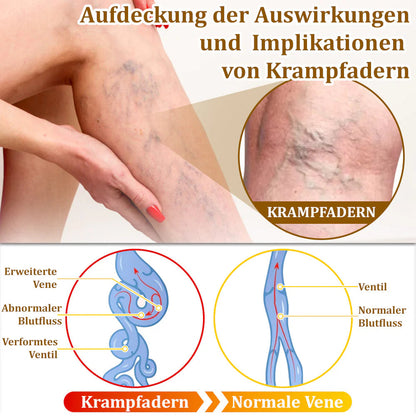 Bostore™ Bienengift-Therapie-Creme, zur Behandlung von Ekzemen, Akne, Altersflecken, Krampfadern, Hautrissen, Pilzinfektionen und Warzen sowie anderen Hautproblemen.👨‍⚕️