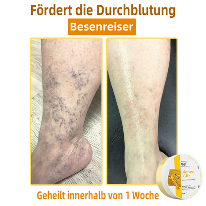 👍 𝐛𝐨𝐬𝐭𝐨𝐫𝐞™ 𝐁𝐢𝐞𝐧𝐞𝐧𝐠𝐢𝐟𝐭-𝐓𝐡𝐞𝐫𝐚𝐩𝐢𝐞-𝐂𝐫𝐞𝐦𝐞 🇩🇪 𝐆𝐨𝐞𝐝𝐤𝐞𝐮𝐫𝐢𝐧𝐠 𝐝𝐨𝐨𝐫 𝐝𝐞𝐫𝐦𝐚𝐭𝐨𝐥𝐨𝐠𝐞𝐧🚀🚀🚀