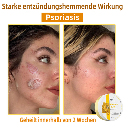 👍 𝐛𝐨𝐬𝐭𝐨𝐫𝐞™ 𝐁𝐢𝐞𝐧𝐞𝐧𝐠𝐢𝐟𝐭-𝐓𝐡𝐞𝐫𝐚𝐩𝐢𝐞-𝐂𝐫𝐞𝐦𝐞 🇩🇪 𝐆𝐨𝐞𝐝𝐤𝐞𝐮𝐫𝐢𝐧𝐠 𝐝𝐨𝐨𝐫 𝐝𝐞𝐫𝐦𝐚𝐭𝐨𝐥𝐨𝐠𝐞𝐧🚀🚀🚀