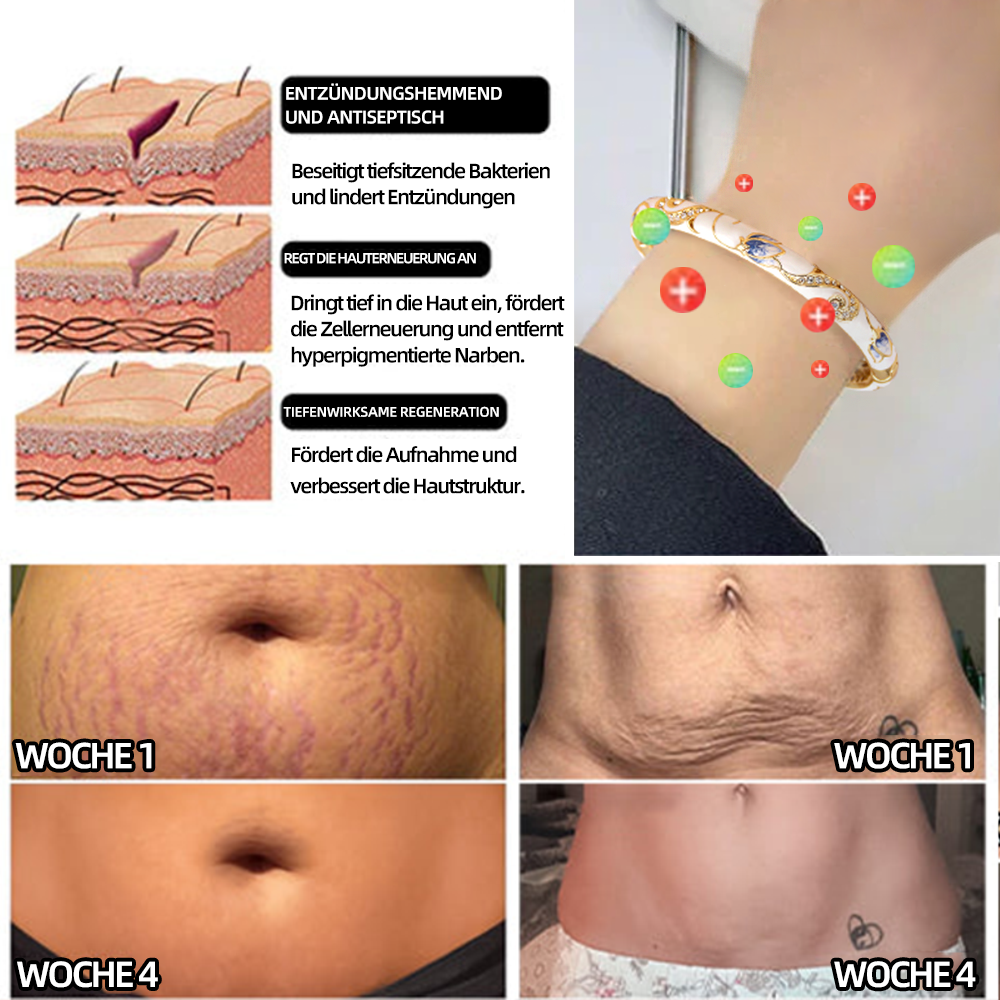𝗖𝗭𝗧𝗜𝗖𝗟𝗘™ 𝗖𝗹𝗼𝗶𝘀𝗼𝗻𝗻é-𝗘𝗺𝗮𝗶𝗹𝗹𝗲-𝗟𝘆𝗺𝗽𝗵𝗮𝘁𝗶𝘀𝗰𝗵𝗲 𝗠𝗮𝗴𝗻𝗲𝘁𝘁𝗵𝗲𝗿𝗮𝗽𝗶𝗲-𝗚𝗼𝗹𝗱𝗮𝗿𝗺𝗯𝗮𝗻𝗱 🌈 𝗦𝗼𝗻𝗱𝗲𝗿𝗮𝗸𝘁𝗶𝗼𝗻 𝗳ü𝗿 𝗸𝘂𝗿𝘇𝗲 𝗭𝗲𝗶𝘁 🔥