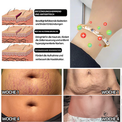 𝗖𝗭𝗧𝗜𝗖𝗟𝗘™ 𝗖𝗹𝗼𝗶𝘀𝗼𝗻𝗻é-𝗘𝗺𝗮𝗶𝗹𝗹𝗲-𝗟𝘆𝗺𝗽𝗵𝗮𝘁𝗶𝘀𝗰𝗵𝗲 𝗠𝗮𝗴𝗻𝗲𝘁𝘁𝗵𝗲𝗿𝗮𝗽𝗶𝗲-𝗚𝗼𝗹𝗱𝗮𝗿𝗺𝗯𝗮𝗻𝗱 🌈 𝗦𝗼𝗻𝗱𝗲𝗿𝗮𝗸𝘁𝗶𝗼𝗻 𝗳ü𝗿 𝗸𝘂𝗿𝘇𝗲 𝗭𝗲𝗶𝘁 🔥
